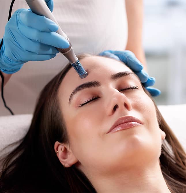 Microneedling
