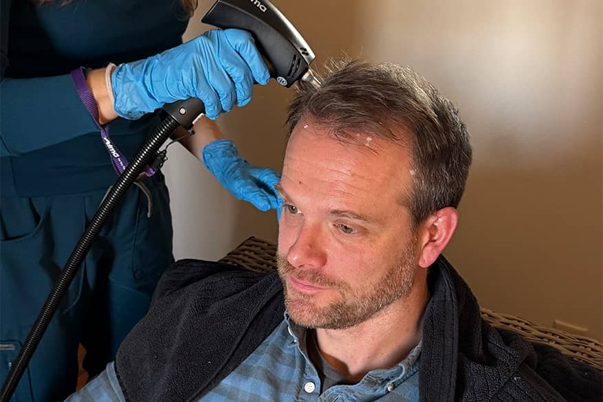 Alma TED Hair Restoration