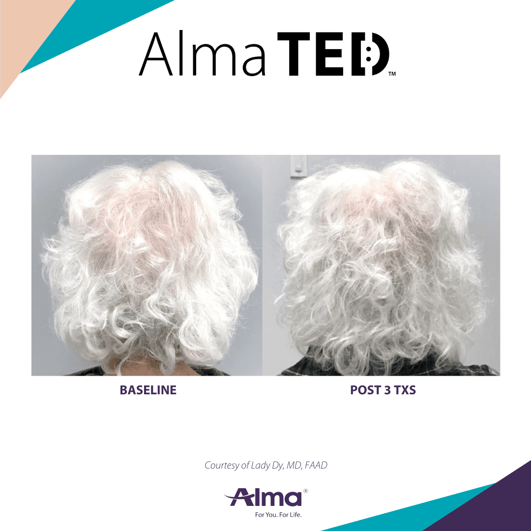 TD-Dy-Case+2-2-22-Q2