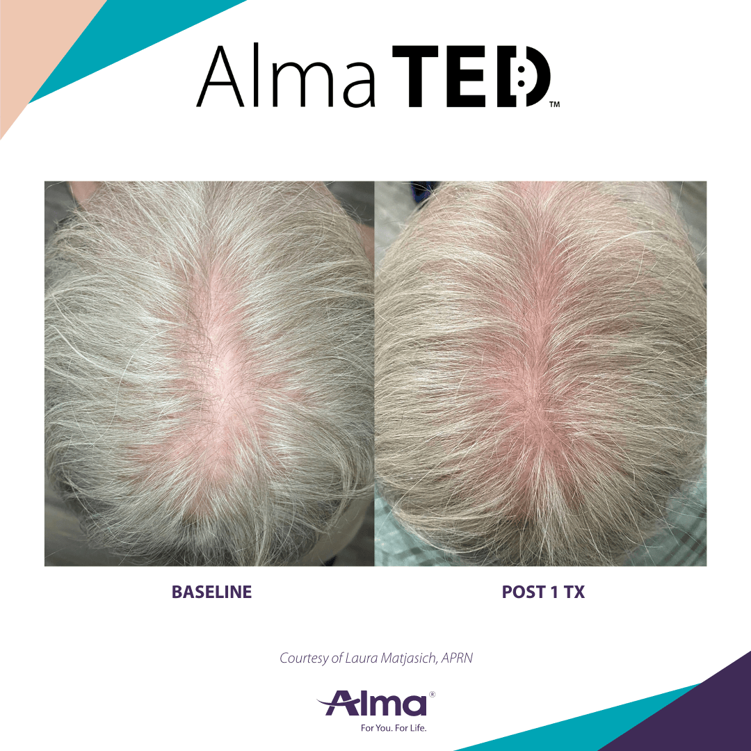 TED-Matjasich-Case 1-1-Q4-22b927f12f45d2585c71f88e9895a0d424d71a2c6a4300665f6e6db01029f82c11