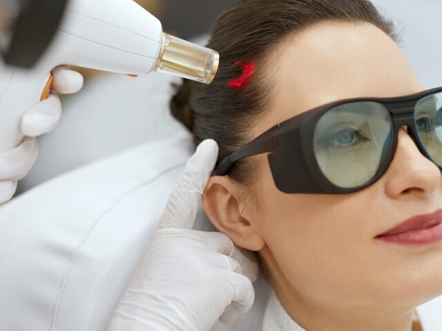 Can You Regrow Hair Without Surgery?