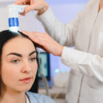 Alma TED Hair Restoration consultation for thinning hair