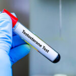 Testosterone Testing consultation for evaluating low testosterone in men