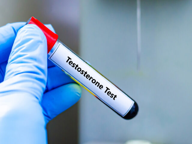 How Do Doctors Check Your Testosterone Levels?