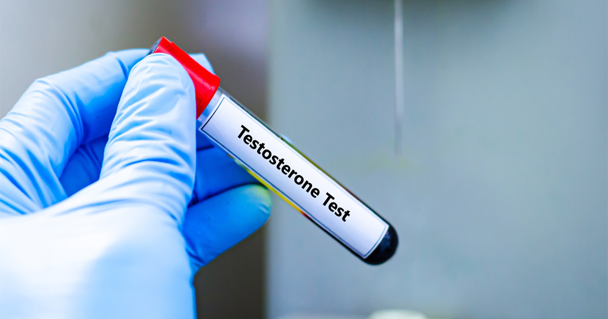 Testosterone Testing consultation for evaluating low testosterone in men