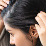 Hair Restoration Treatment for early hair thinning evaluation