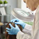 Alma TED Treatment for hair restoration